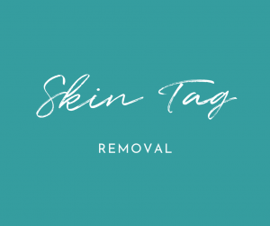 Skin Tag Removal Oxfordshire